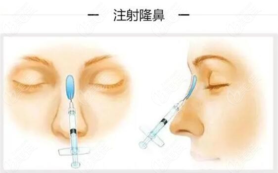 鼻基底技術革新，觀點論述與突破